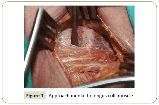 Spine-Research-Approach-medial