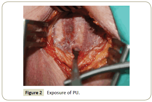 Spine-Research-Exposure