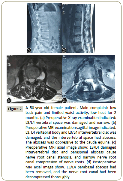 Spine-Research-damaged