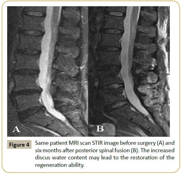 Spine-Research-surgery-posterior-spinal