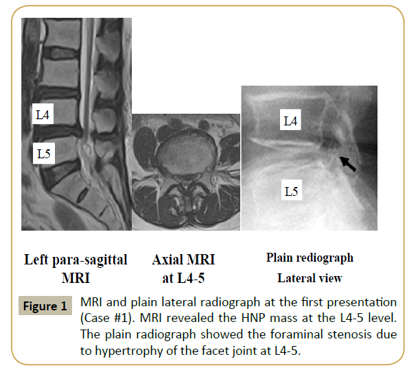 spine-MRI-radiograph