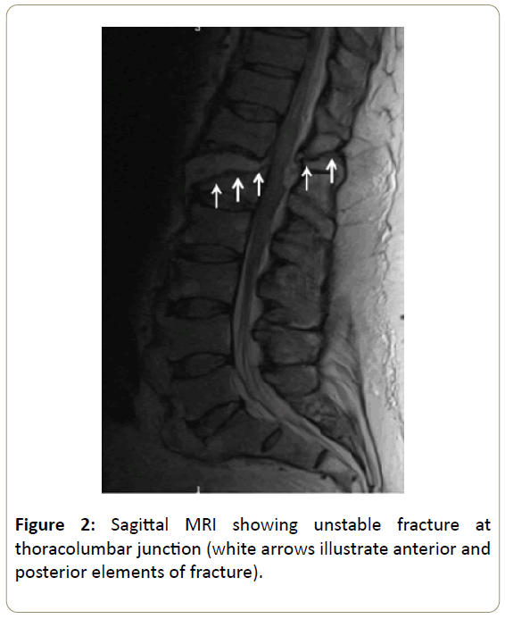 spine-Sagittal-MRI