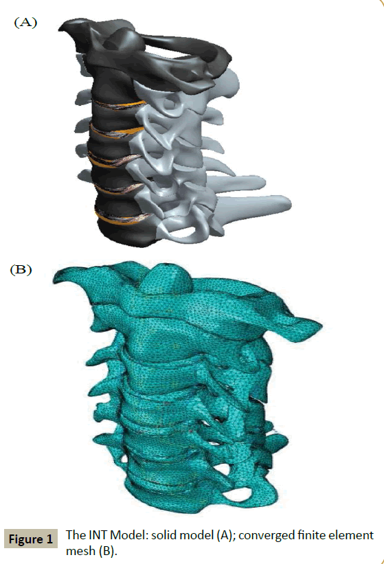 spine-converged-finite-element