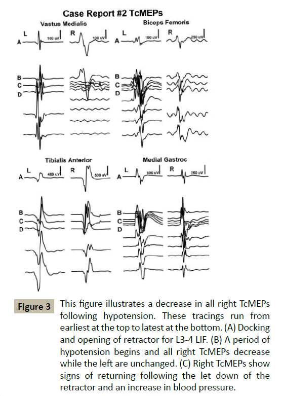 spine-figure-illustrates-decrease