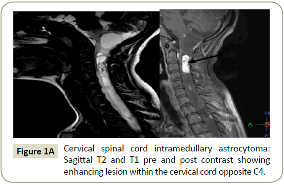 spine-post-contrast