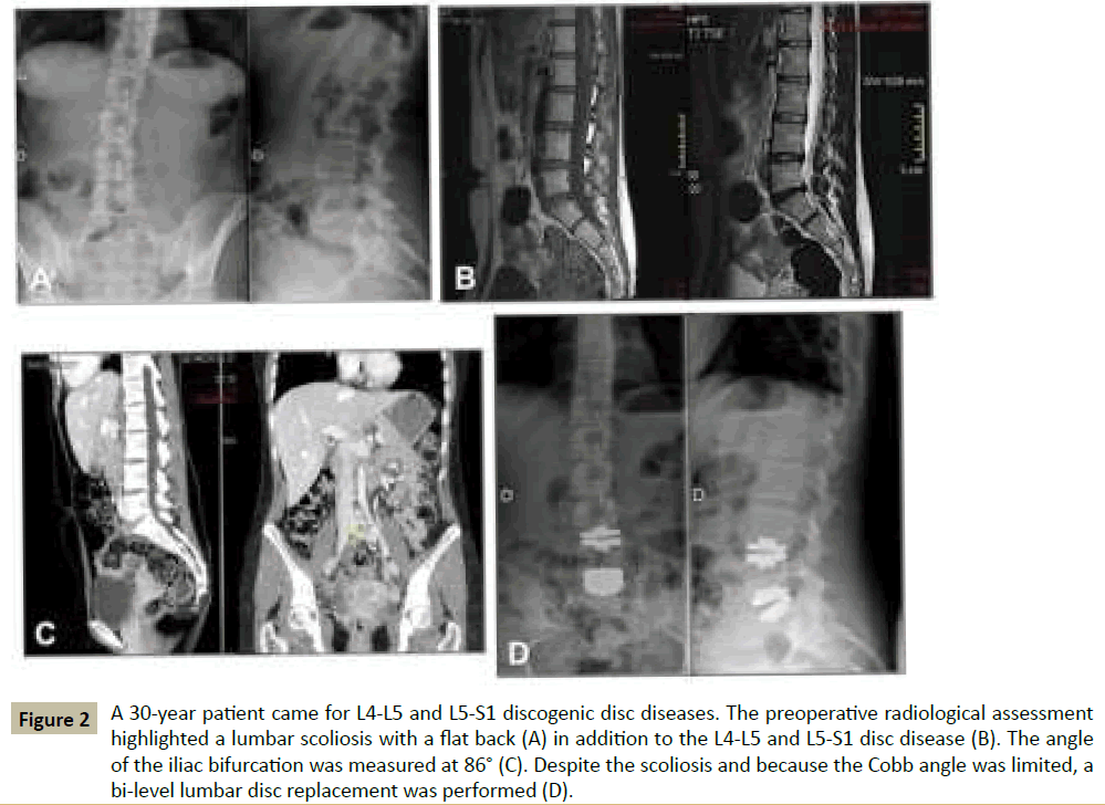 spine-preoperative-radiological-assessment