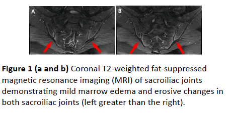 spine-research-fat-suppressed-magnetic