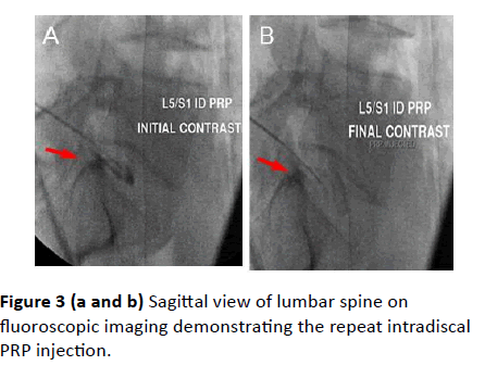 spine-research-fluoroscopic-imaging