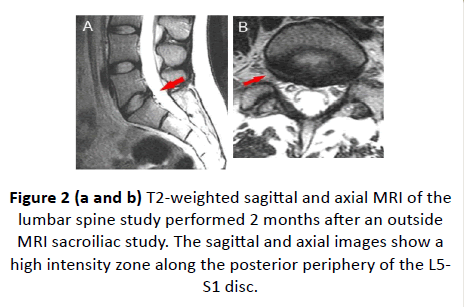 spine-research-weighted-sagittal