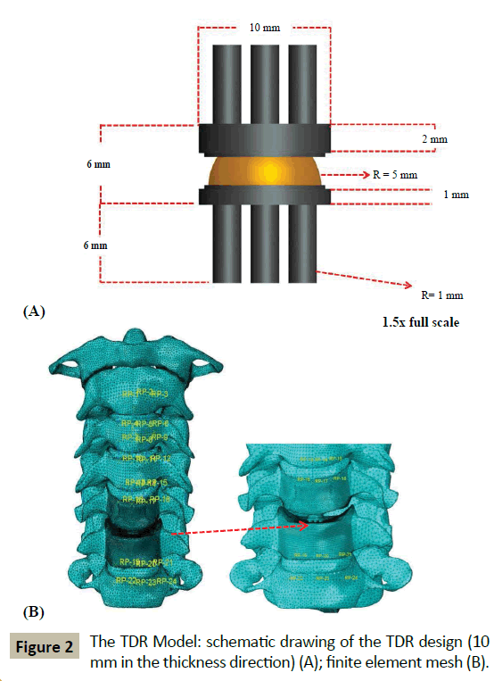 spine-schematic-drawing