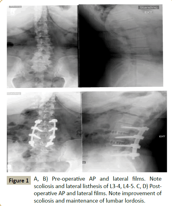 spine-scoliosis-maintenance