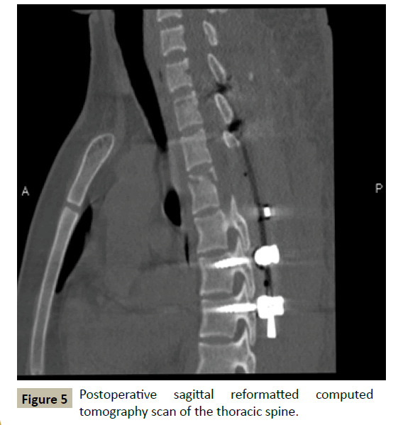 spine-thoracic-spine