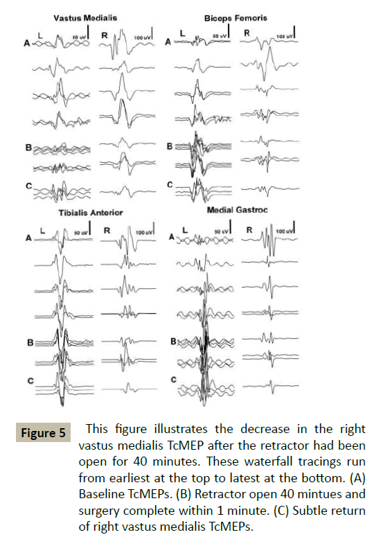 spine-waterfall-tracings-run